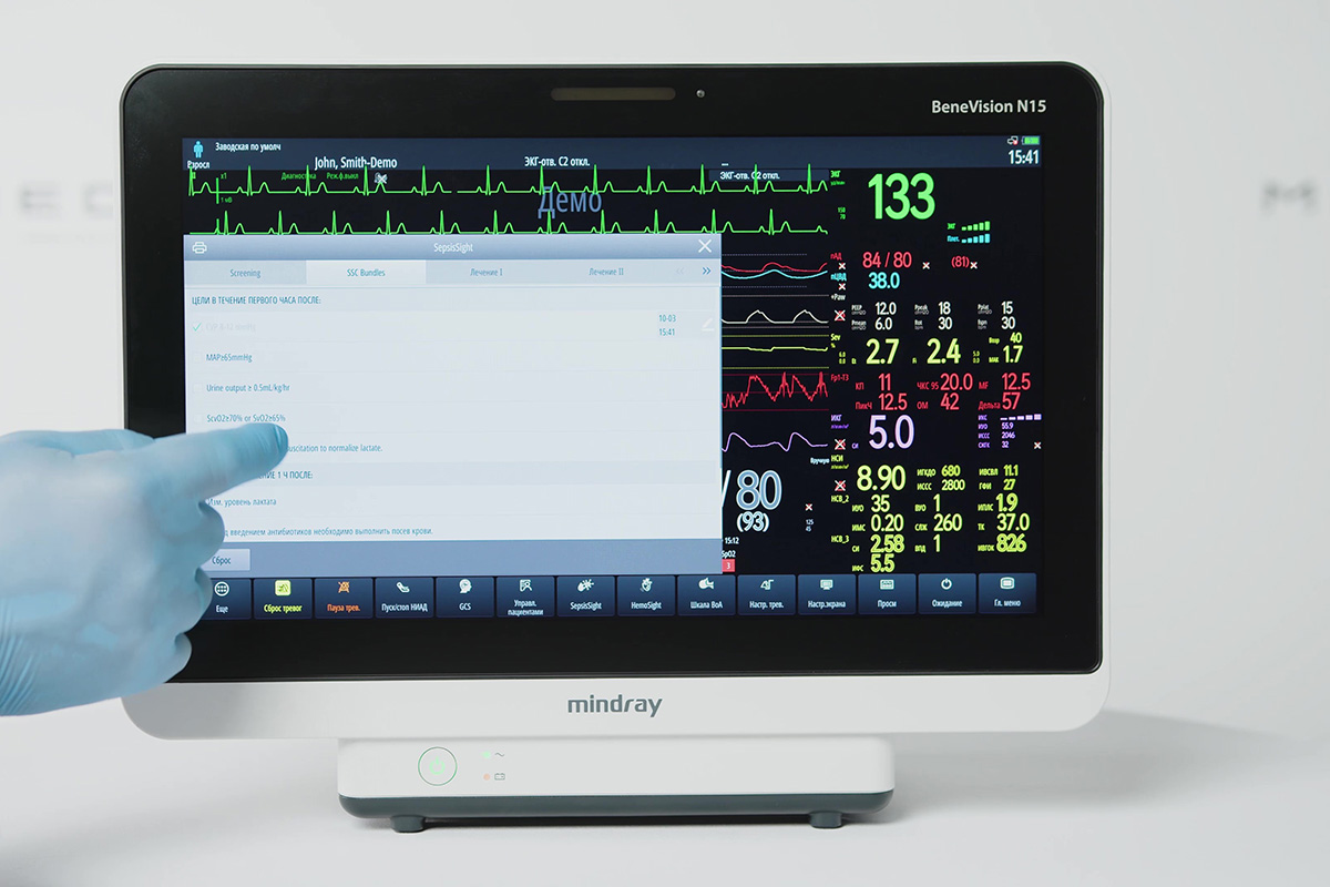 Вспомогательные клинические приложения (CAA) в мониторах Mindray Benevision N-серии