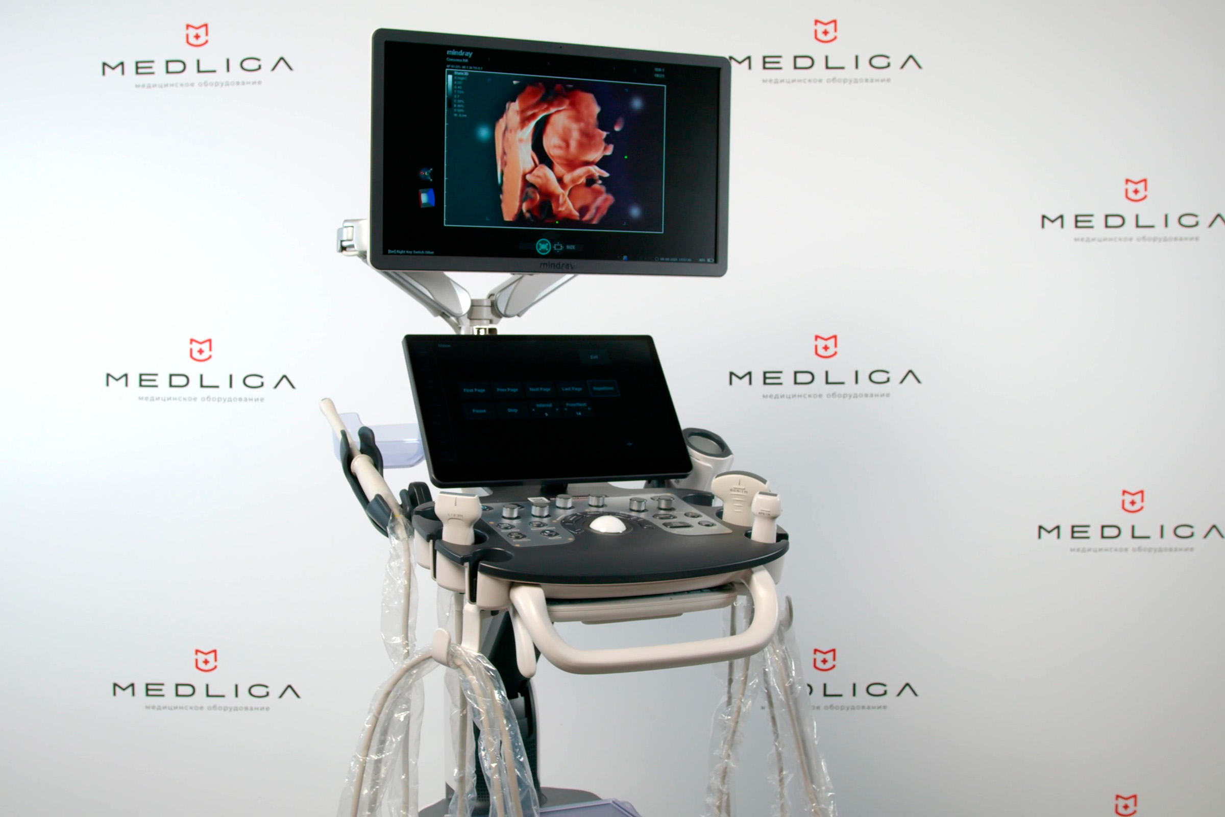 Видеообзор УЗИ аппарата Mindray Consona N8