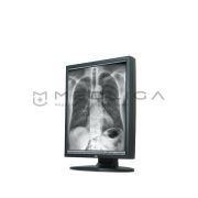 Мониторы для рентгенологии JVC