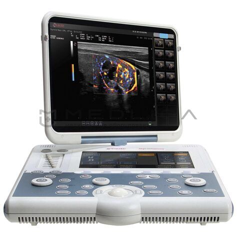 Esaote MyLab Gamma, 2